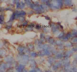 Anti-CBPN antibody - Click Image to Close